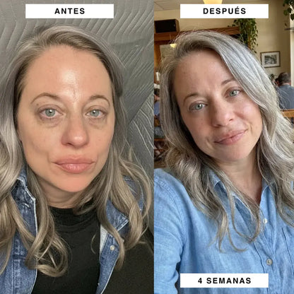 skincare koreano + parches antiojeras de regalo