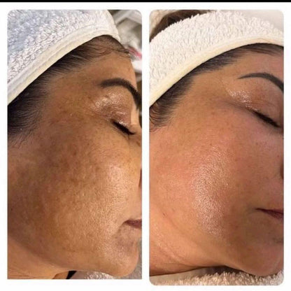 skincare koreano + parches antiojeras de regalo